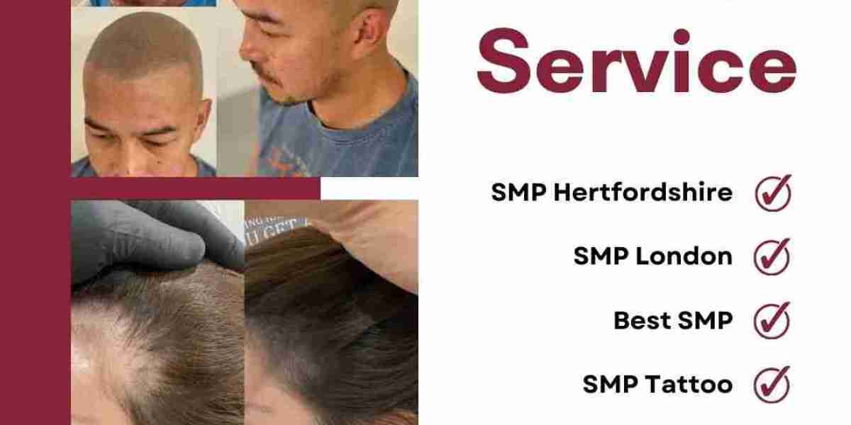 The Science of Scalp Micropigmentation: How SMP London is Changing Lives Forever